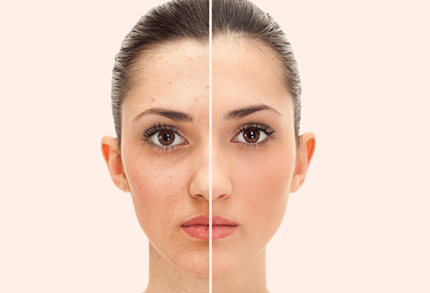 face lift treatment in Navi Mumbai