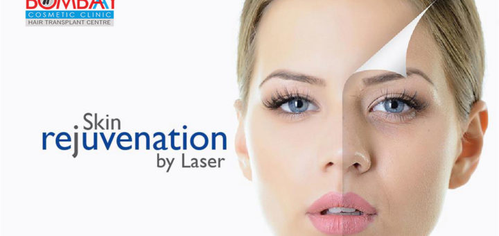 Skin laser treatment in Vashi